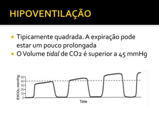 


Tipicamente quadrada. A expiração pode
estar um pouco prolongada
O Volume tidal de CO2 é superior a 45 mmHg

 
