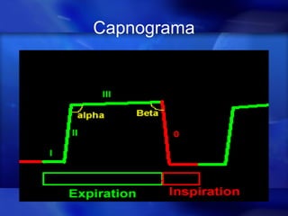Capnograma
 