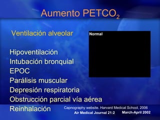 Aumento PETCO2
Ventilación alveolar
Hipoventilación
Intubación bronquial
EPOC
Parálisis muscular
Depresión respiratoria
Obstrucción parcial vía aérea
Reinhalación March-April 2002Air Medical Journal 21:2
Capnography website. Harvard Medical School, 2006
 