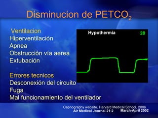 Disminucion de PETCO2
Ventilacion
Hiperventilación
Apnea
Obstrucción vía aerea
Extubación
Errores tecnicos
Desconexión del circuito
Fuga
Mal funcionamiento del ventilador
March-April 2002Air Medical Journal 21:2
Capnography website. Harvard Medical School, 2006
 