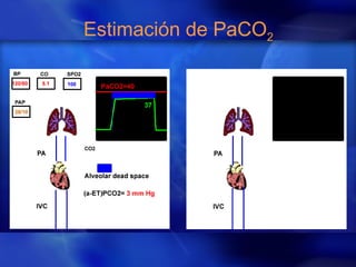 Estimación de PaCO2
 