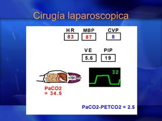 Cirugía laparoscopica
 