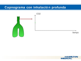  Capnograma con inhalació n profunda 
CO2 
tiempo 
 