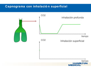  Capnograma con inhalació n superficial 
CO2 
inhalación profunda 
tiempo 
CO2 
Inhalación superficial 
tiempo 
 