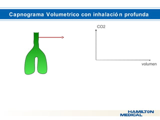  Capnograma Volumetrico con inhalació n profunda 
CO2 
volumen 
 