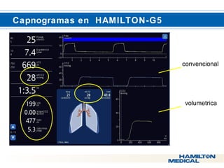  Capnogramas en HAMILTON-G5 
convencional 
volumetrica 
 