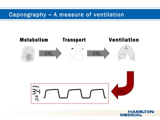  Capnography – A measure of ventilation 
Metabolism 
CO2 
Transport 
CO2 
ETCO2 
RR 
Ventilation 
CO2 
 