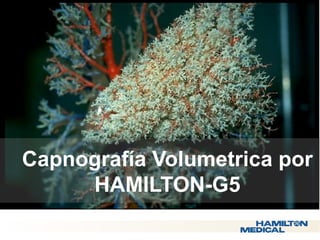  Capnografía Volumetrica por 
HAMILTON-G5 
 