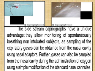 CALIBRATION
• Capnographs must be calibrated periodically
• At least daily acc to manufacturers for main
  stream
• Automa...
