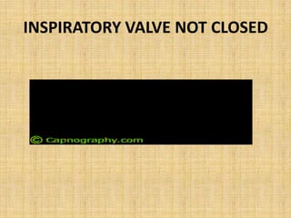 EXPIRTORY VALVE DYSFUNCTION
• Expiratory valve stuck
• Increased inspiratory co2
 