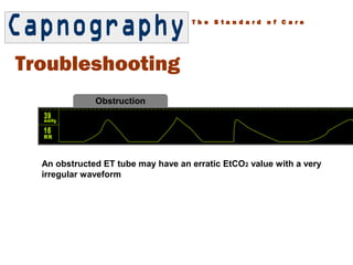 Obstructive Pattern Capnography Capnography | PPT