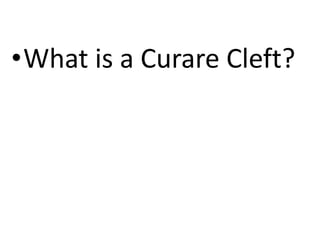 •What is a Curare Cleft?
 