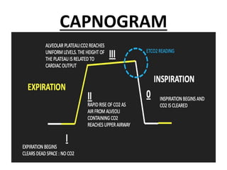 CAPNOGRAM
 