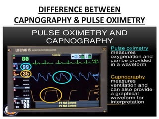 DIFFERENCE BETWEEN
CAPNOGRAPHY & PULSE OXIMETRY
 