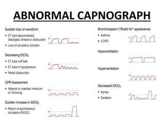 ABNORMAL CAPNOGRAPH
 