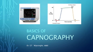 CAPNOGRAPHY
BASICS OF
Dr. GT Wijesinghe. MBBS
 
