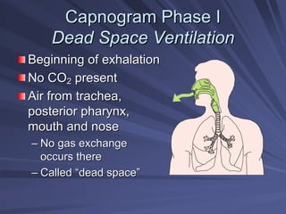Capnogram Phase I
Capnogram Phase I
Dead Space Ventilation
Dead Space Ventilation
Beginning of exhalation
Beginning of exhalation
No CO
No CO2
2 present
present
Air from trachea,
Air from trachea,
posterior pharynx,
posterior pharynx,
mouth and nose
mouth and nose
–
– No gas exchange
No gas exchange
occurs there
occurs there
–
– Called
Called “
“dead space
dead space”
”
 