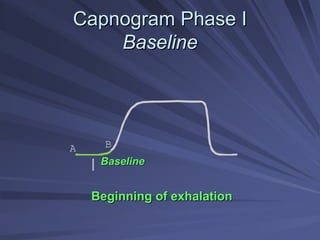 Capnogram Phase I
Capnogram Phase I
Baseline
Baseline
Beginning of exhalation
Beginning of exhalation
A B
I Baseline
Baseline
 