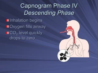 Capnogram Phase IV
Capnogram Phase IV
Descending Phase
Descending Phase
Inhalation begins
Inhalation begins
Oxygen fills airway
Oxygen fills airway
CO
CO2
2 level quickly
level quickly
drops to zero
drops to zero
Alveoli
 