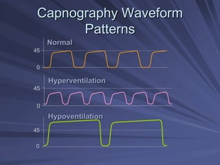 Capnography Waveform
Capnography Waveform
Patterns
Patterns
0
45
Hypoventilation
Hypoventilation
45
0
Hyperventilation
Hyperventilation
45
0
Normal
Normal
 