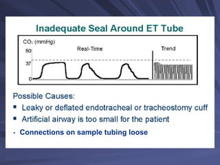 • Connections on sample tubing loose
 