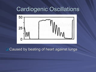 Cardiogenic
Cardiogenic Oscillations
Oscillations
‰
‰ Caused by beating of heart against lungs
Caused by beating of heart against lungs
 