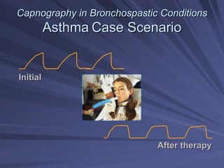 Capnography in
Capnography in Bronchospastic
Bronchospastic Conditions
Conditions
Asthma
Asthma Case Scenario
Case Scenario
Initial
Initial
After therapy
After therapy
 