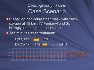 Capnography in CHF
Capnography in CHF
Case Scenario
Case Scenario
Placed on non
Placed on non-
-rebreather
rebreather mask with 100%
mask with 100%
oxygen at 15 L/m; IV Fentanyl and SL
oxygen at 15 L/m; IV Fentanyl and SL
Nitroglycerin as per local protocol
Nitroglycerin as per local protocol
Ten minutes after treatment:
Ten minutes after treatment:
SpO
SpO2
2 69% 99%
69% 99%
EtCO
EtCO2
2 17mmHG 35
17mmHG 35 mmHG
mmHG
4 5
3 5
0
2 5
Time condensed
Time condensed
to show changes
to show changes
 