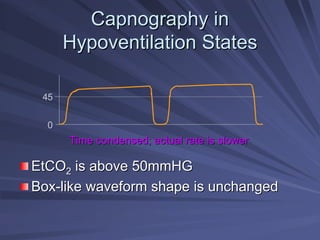 Capnography in
Capnography in
Hypoventilation States
Hypoventilation States
EtCO
EtCO2
2 is above 50mmHG
is above 50mmHG
Box
Box-
-like waveform shape is unchanged
like waveform shape is unchanged
45
0
Time condensed; actual rate is slower
Time condensed; actual rate is slower
 