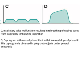 detailed capnography in anaesthesia .pptx