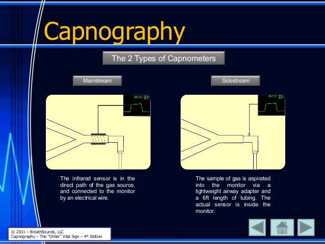 Capnography the other vital sign
