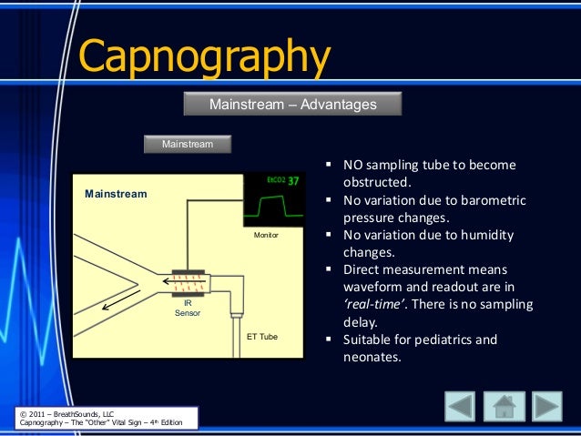 graph n connected other sign vital the Capnography