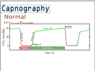 capnography 11.pptx this is about capnography | PPTX