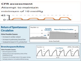 capnography 2025.pptx about capnography new details | PPTX
