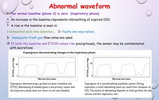 Abnormal waveform
 The normal baseline (phase I) is zero. (inspiratory phase)
 An increase in the baseline represents rebreathing of expired CO2.
 A rise in the baseline is seen in:
1-exhausted soda lime absorber, 2- faulty one-way valves,
3- inadequate fresh gas flow rates are used.
 If both the baseline and ETCO2 values rise precipitously, the sensor may be contaminated
with secretions.
 