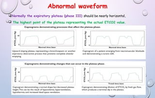 Abnormal waveform
Normally the expiratory plateau (phase III) should be nearly horizontal,
 The highest point of the plateau representing the actual ETCO2 value.
 