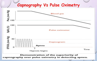 Capnography Vs Pulse Oximetry
 