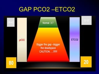 Capnography in icu | PPTX