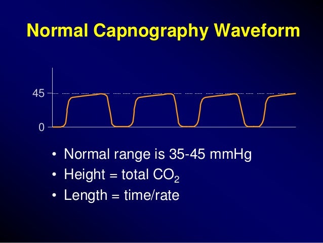 Capnography in icu Capnography in icu - 638 x 479 jpeg 50kB