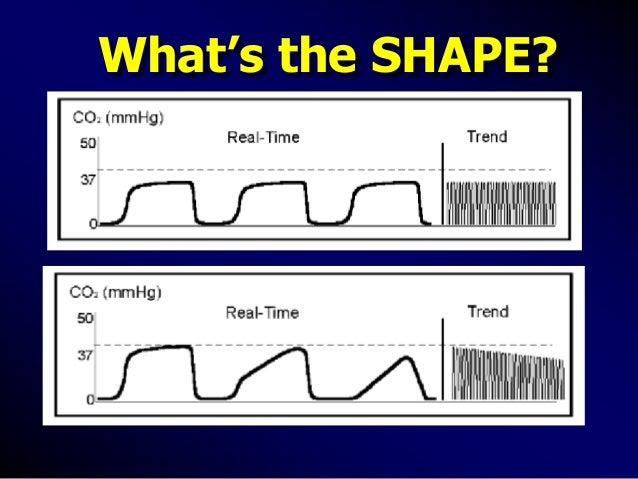 what's absorber oxygen in Capnography icu what's absorber oxygen in Capnography icu
