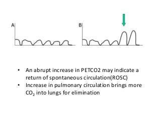 Capnography and interpretations | PPTX