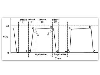 Capnography and interpretations | PPTX