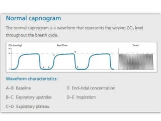 Capnography and interpretations | PPTX