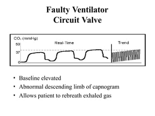 CAPNOGRAPHY monitoring intra op settings | PPTX