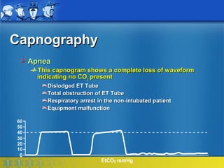 Capnography
     Apnea
       This capnogram shows a complete loss of waveform
       indicating no CO2 present
          Dislodged ET Tube
          Total obstruction of ET Tube
          Respiratory arrest in the non-intubated patient
          Equipment malfunction

60
50
40
30
20
10
 0
                              EtCO2 mmHg
 