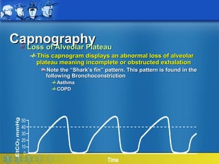 Capnography
  Loss of Alveolar Plateau
        This capnogram displays an abnormal loss of alveolar
        plateau meaning incomplete or obstructed exhalation
           Note the “Shark’s fin” pattern. This pattern is found in the
           following Bronchoconstriction
               Asthma
               COPD




   50
   40
   30
   20
   10
    0
                                   Time
 