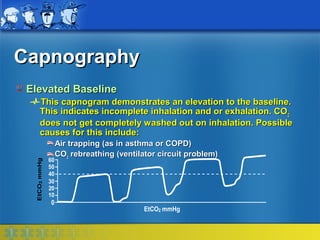 Capnography
 Elevated Baseline
   This capnogram demonstrates an elevation to the baseline.
   This indicates incomplete inhalation and or exhalation. CO2
   does not get completely washed out on inhalation. Possible
   causes for this include:
          Air trapping (as in asthma or COPD)
          CO2 rebreathing (ventilator circuit problem)
     60
     50
     40
     30
     20
     10
     0
                                  EtCO2 mmHg
 