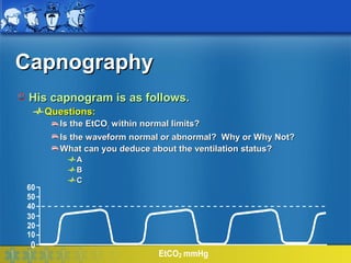Capnography
 His capnogram is as follows.
     Questions:
       Is the EtCO2 within normal limits?
       Is the waveform normal or abnormal? Why or Why Not?
       What can you deduce about the ventilation status?
           A
           B
           C
60
50
40
30
20
10
 0
                            EtCO2 mmHg
 