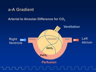 a-A Gradient
r r Alveolus
PaCO2
VeinA te y
Ventilation
Perfusion
Arterial to Alveolar Difference for CO2
Right
Ventricle
L...