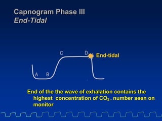 end tidal co2 monitoring ppt
